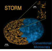 CRG_ChromatineSTORMImage