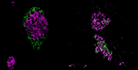 The image shows pancreatic islets in mice, specialised tissues that host beta cells. On the left, a healthy pancreatic islet is shown with its typical morphology with alpha cells in the periphery and beta cells in the core of the islet. On the right, mice with a mutation in Srrm3 that knock out the cells’ ability to regulate microexon inclusion results in islets with altered morphology and cell identity. This and other functional alterations ultimately impacts on the release of insulin. Jonas Juan Mateu