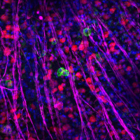 Degenerating retina transplanted with stem cells expressing Ccr5 and Cxcr6. Green are the transplanted cells, red and magenta are retinal neurons. Credit: Martina Pesaresi Pia Cosma