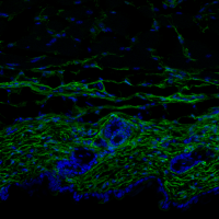 Skin of a young mouse. The image shows a cross section of the skin with the fibroblasts indicated in green. The thickness of the dermis and the density of fibroblasts is much greater in young skin than in aged skin– cell nuclei, in blue (M Salzer, IRB Barcelona)