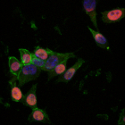 β-catenin is heterogeneously expressed in mouse Embryonic Stem Cells.