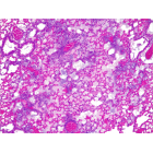 This shows a cross-section of a mouse lung infected with Pseudonomas aeruginosa. The mouse was treated with a version of Mycoplasma pneumoniae that could not produce therapeutic molecules, resulting in severe pneumoniae. This is characterised by massive infiltration of inflammatory cells into the alveolar septa, resulting in loss of air in the alveoli. Credit: Rocco Mazzolini/CRG   