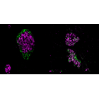 The image shows pancreatic islets in mice, specialised tissues that host beta cells. On the left, a healthy pancreatic islet is shown with its typical morphology with alpha cells in the periphery and beta cells in the core of the islet. On the right, mice with a mutation in Srrm3 that knock out the cells’ ability to regulate microexon inclusion results in islets with altered morphology and cell identity. This and other functional alterations ultimately impacts on the release of insulin. Jonas Juan Mateu