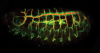 Tumours_Drosophila intestine_JCasanova.tif: Tumors en l’intestí de mosca Drosophila adulta, model per estudiar el càncer de còlon humà. Crèdits: Jordi Casanova, IRB Barcelona/ IBMB-CSIC Andreu Casali, IRB Barcelona, Òscar Martorell, IRB Barcelona